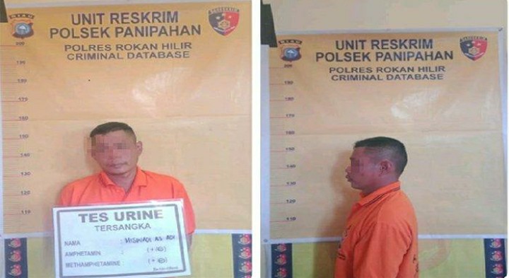 Kasihan Gadis Kecil di Rohil, Pahanya Melepuh Disundut Rokok Ayah Tiri, Ibunya Berang Lapor Polisi