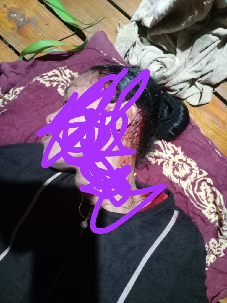 Polisi di Biringbulu Gowa Diduga Lakukan Pembiaran Kasus Penganiayaan Terhadap Seorang Janda