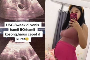 Divonis Hamil Kosong, Ayu Bertekad Mempertahankan Kehamilannya, Malah Janinnya Sehat