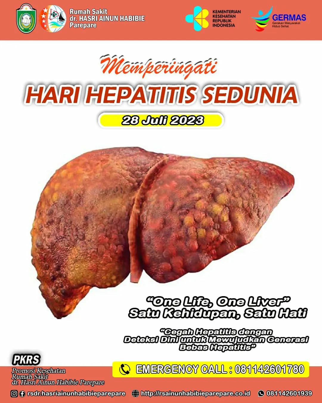 Hari Hepatitis Sedunia, RS Hasri Ainun Habibie Ajak Wujudkan Generasi Bebas Hepatitis dengan Cegah Dini 