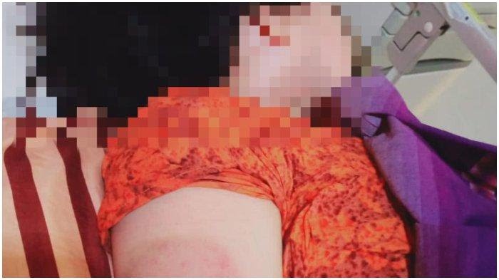Oknum Polisi di Parepare Aniaya Istrinya Secara Sadis, Dibenturkan ke Tembok Lalu Dihantam Pakai Balok