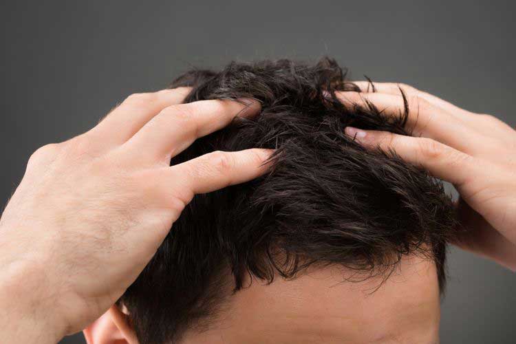 7 Penyebab Rambut Kering pada Laki-laki, Termasuk Sering Keramas dan Gaya Hidup