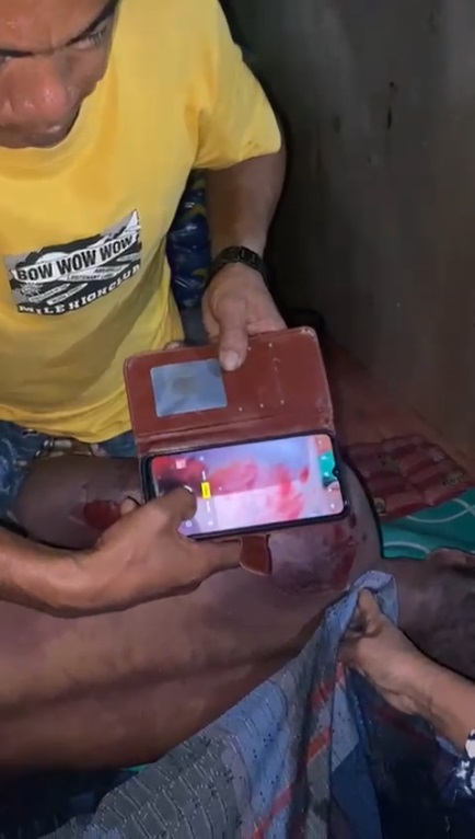 Ditangkap Atas Tuduhan Pencurian Biji Kakao, Tahanan di Polres Polman Meninggal Dunia 